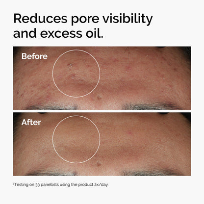 The Ordinary Niacinamide 10% + Zinc 1% - 30ml